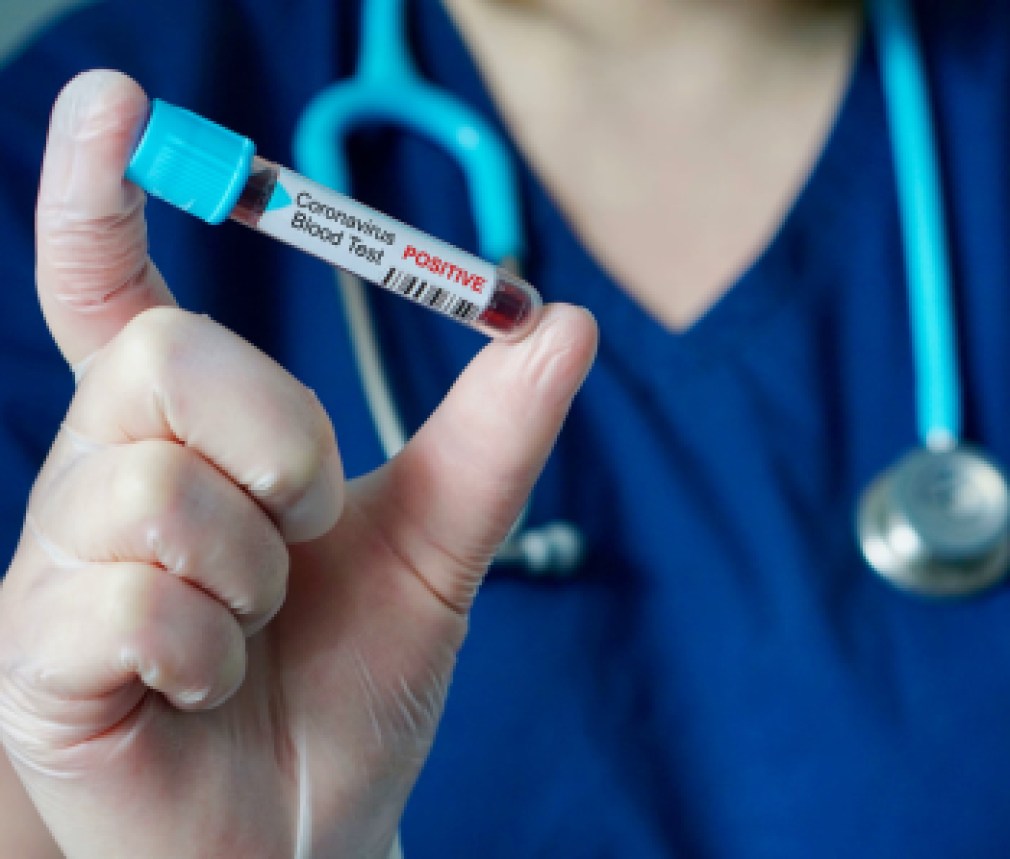 Nurse holding a positive blood test result for the new rapidly spreading Coronavirus, originating in Wuhan, China